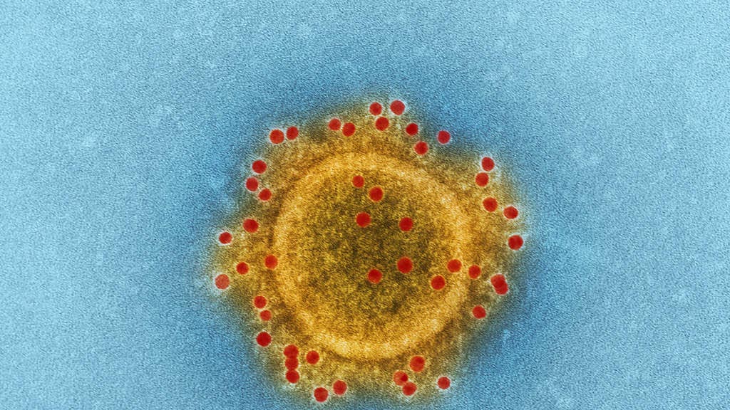 Aruba heeft eerste geval Indiase coronavariant